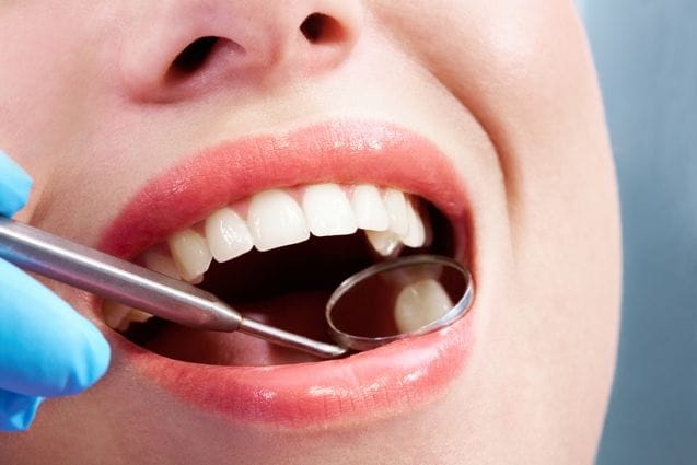 Science: Devious bacteria can cause multiple cavities