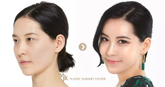 Don’t force us to have facelifts, say South Korean women in backlash over beauty ideals
