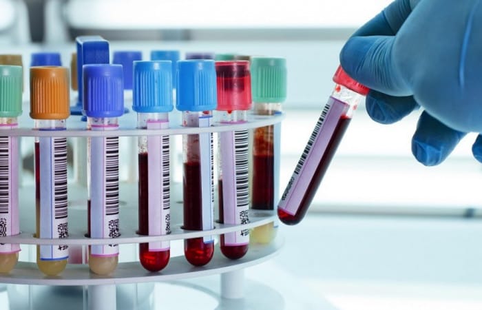 Researchers detect signs of cancer risk in blood years in advance of disease