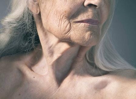 Rapamycin can help to fight aging
