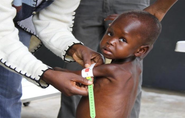 Nigeria: Acute malnutrition hits children