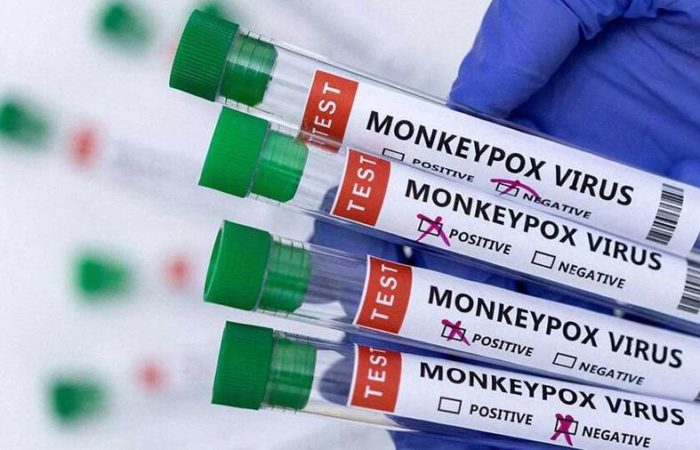 First case of monkeypox confirmed in Turkey